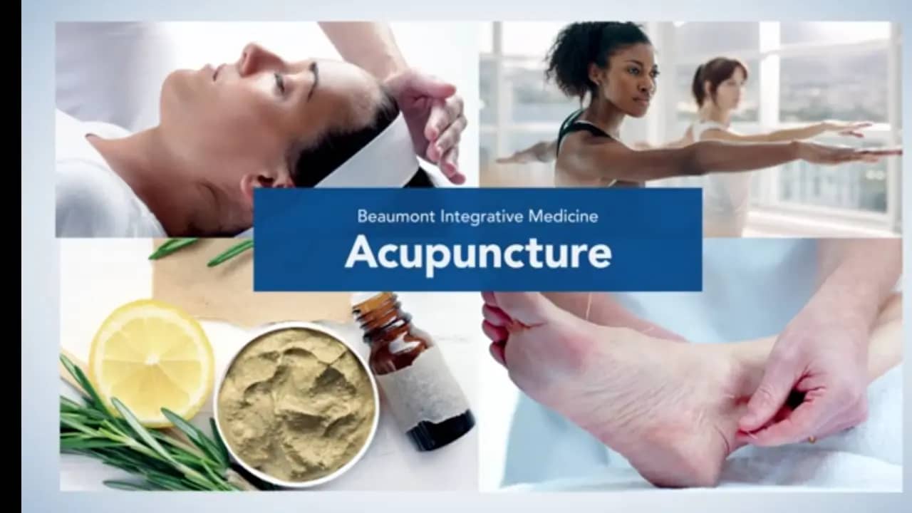 Acupuncture | Beaumont Integrative Medicine